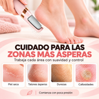 Removedor de Callos Eléctrico Recargable USB para Pies
